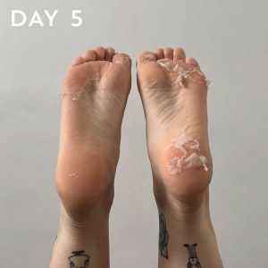 Additional picture of Maskology Foot Peel