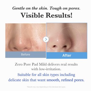 Additional picture of Medicube Zero Pore Pad Mild 155g