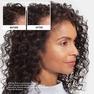 Additional picture of Nioxin Anti Hair Loss Spoo 475 ml