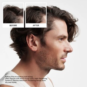 Additional picture of Nioxin Scalp+Hair 2 Treatment 100ml