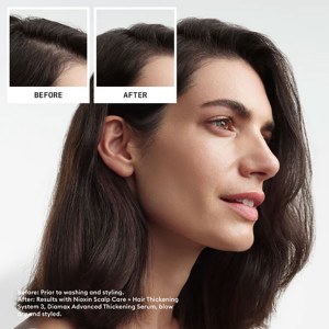Additional picture of Nioxin Scalp+Hair 3 Treatment 100ml
