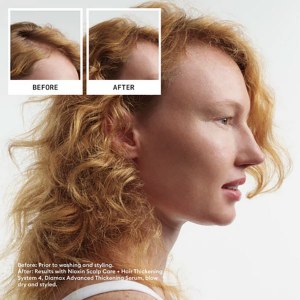 Additional picture of Nioxin Scalp+Hair 4 Treatment 100ml