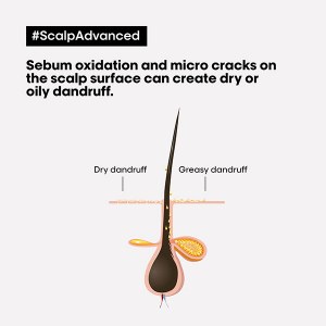 Additional picture of SA Anti-Discomfort Spoo1.5L Scalp Advance