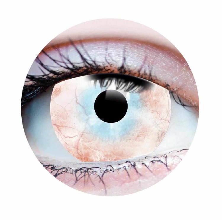 Primal Contacts Plague