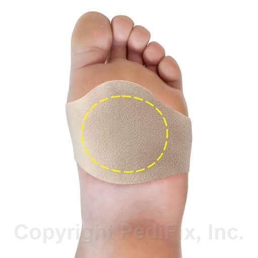 PediFix Visco-GEL Ball-of-Foot Wrap- Large